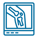 Reemplazos articulares de alta precisión