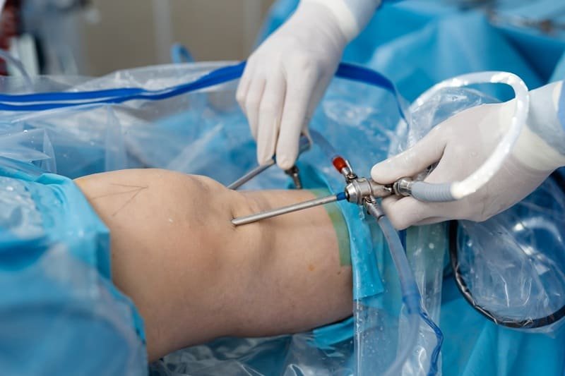 Artroscopia de rodilla